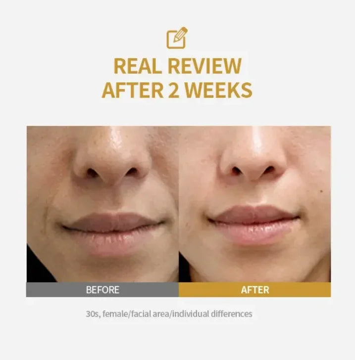 Kojic Acid Turmeric Facial Ampoule Serum with Niacinamide Deep Moisturizing Nourishing Evens Skin Tone Skin Care