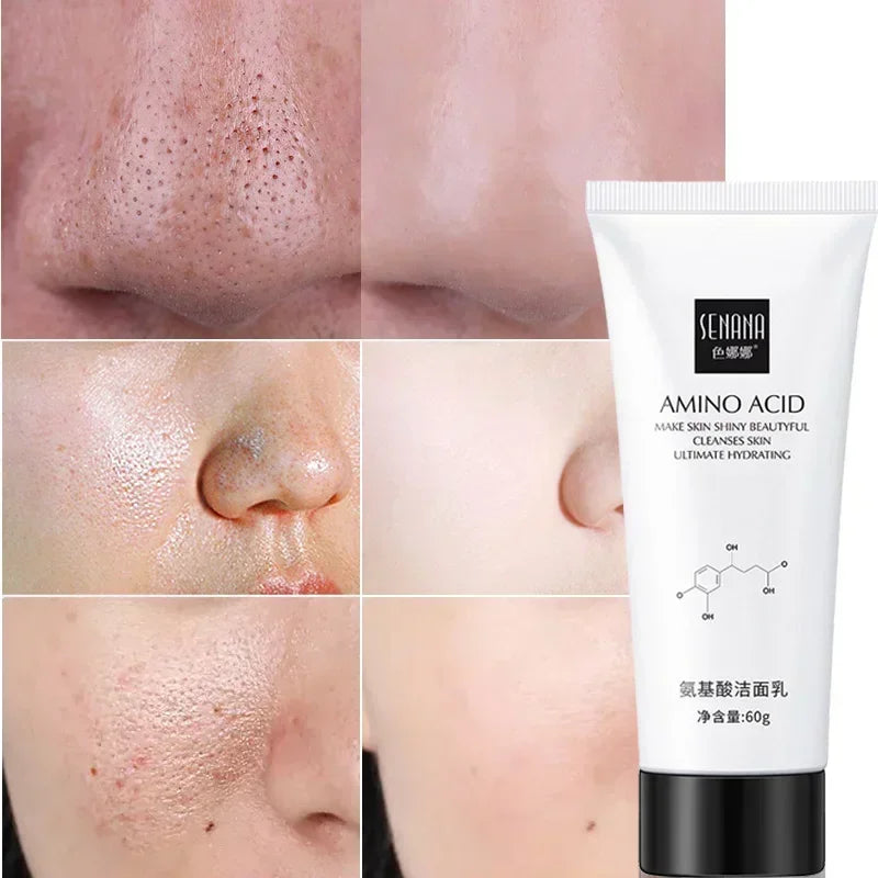 Nicotinamide Amino Acid Face Cleanser Facial Scrub Cleansing Acne Oil Control Blackhead Remover Shrink Pores Skin Care