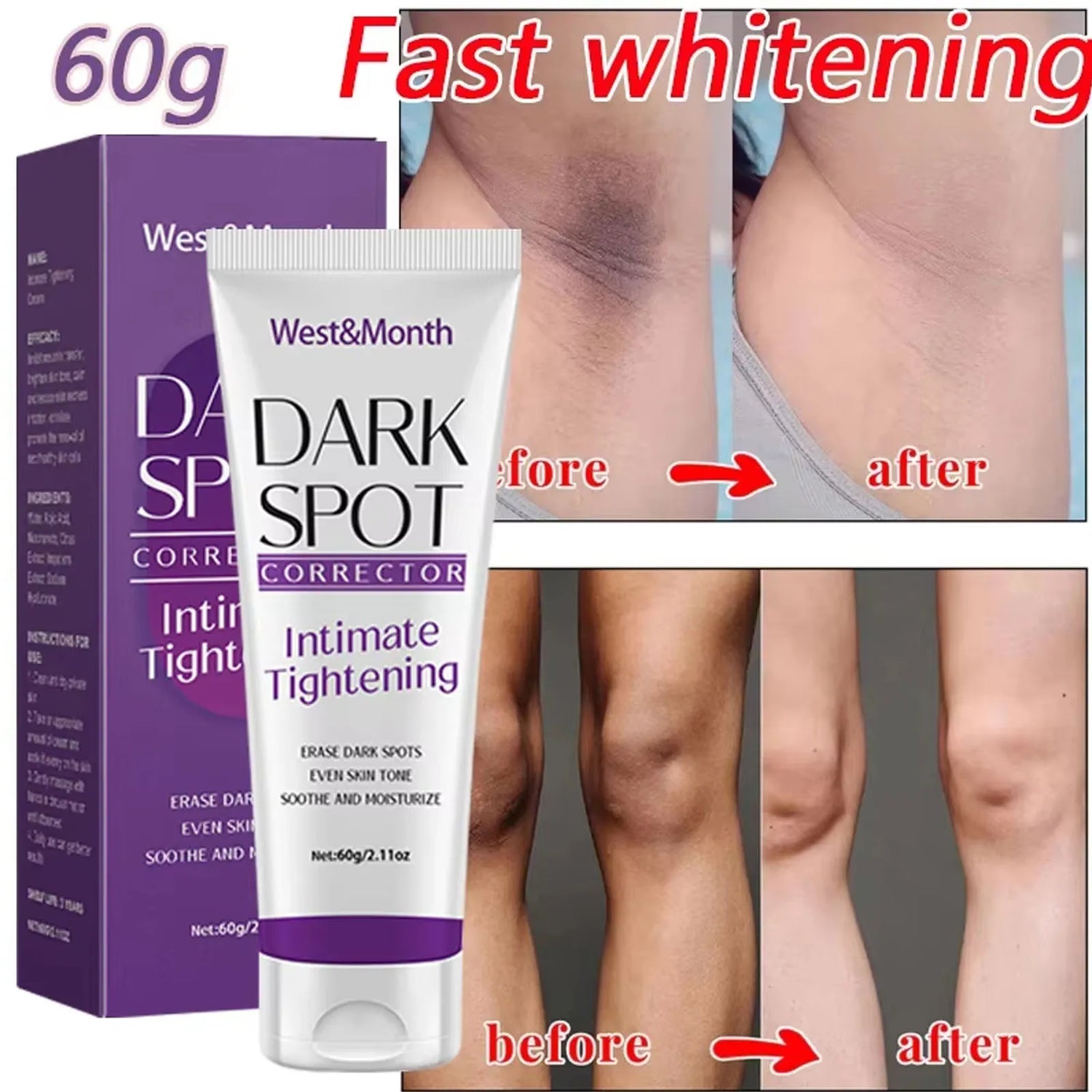 Body Brightening Lotion Dark Spot Remover For Underarms Knees Elbows Melanin Bleaching Lightening Skin Moisturizing Cream 60g