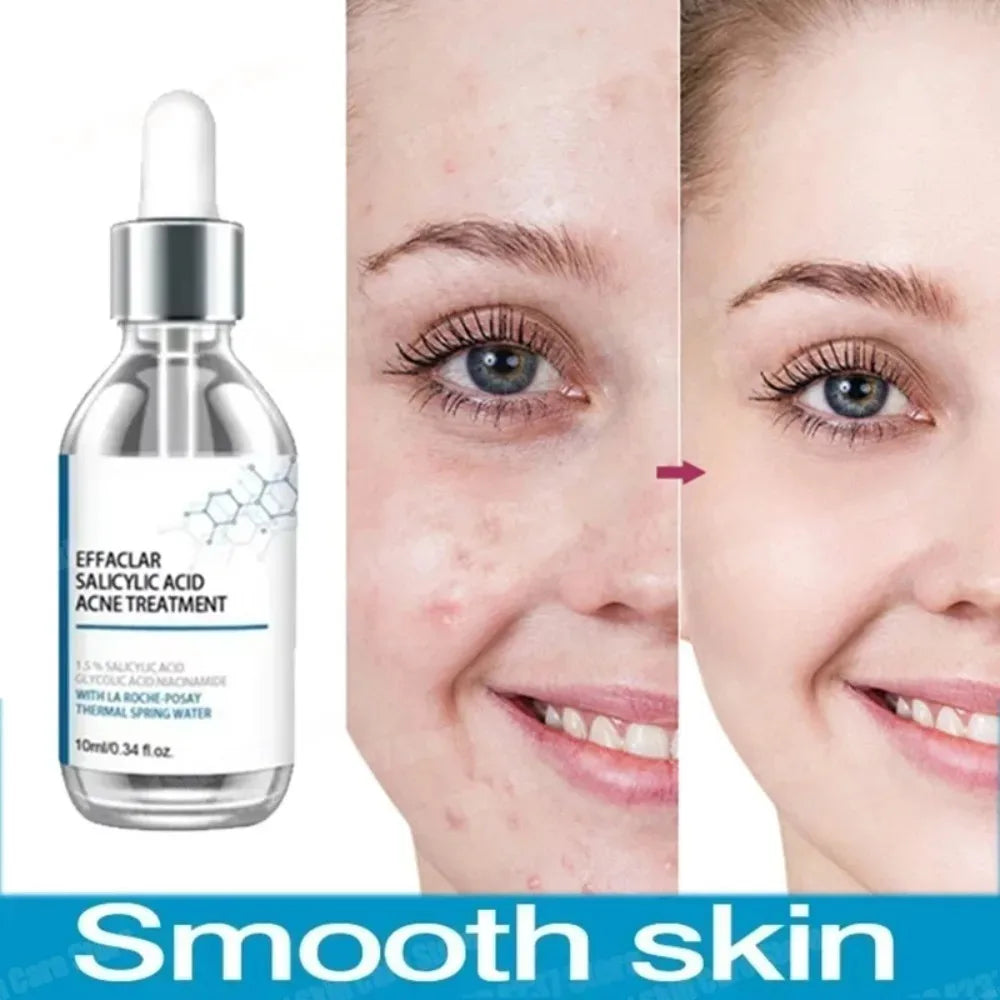 Salicylic Acid  Solution Essence Shrink pores and Acne Spot Removing Shrink Pores Oil-Control Brighten Face Skin Makeup