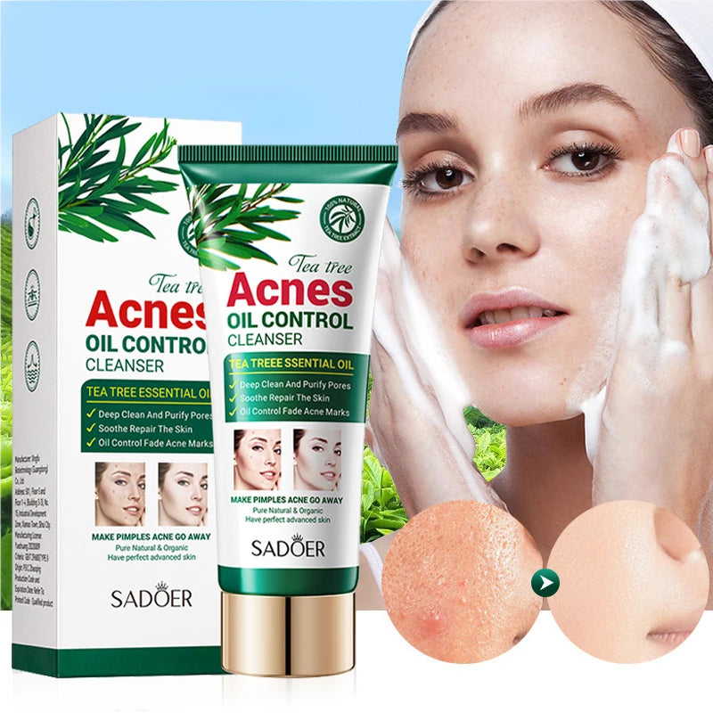 SADOER Tea Tree Acne Removal Facial Cleanser Moisturizing Anti-aing Anti Acne Deep Cleansing Face Wash Foam Cleanser Skin Care