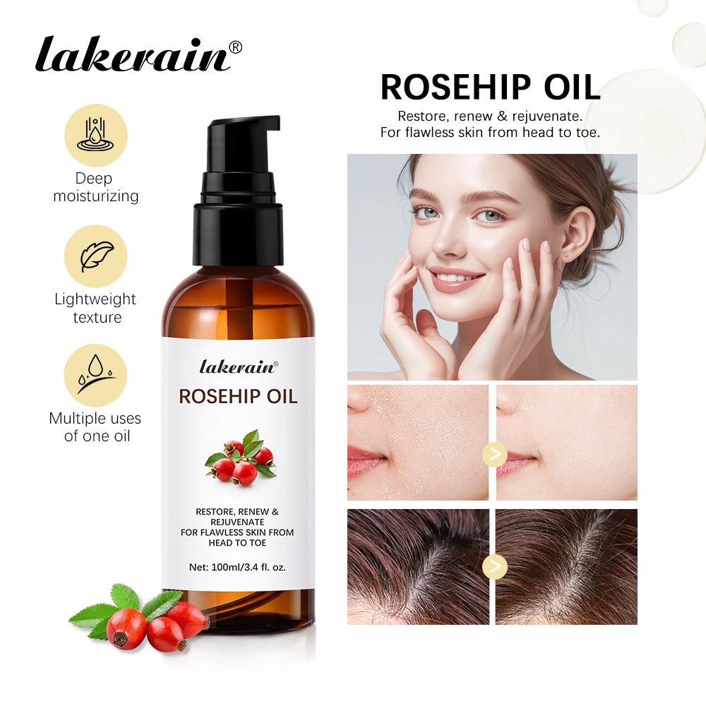 Organic Rosehip Oil Rose Hips Face Oils 30ml Fast-Absorbing For Anti-aging Scar Treatment Skin Care Moisturizer Face Oil