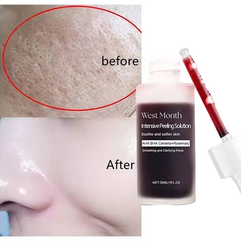 Salicylic Acid Meets Pore Perfection – Shrinks Enlarged Pores, Minimizes Appearance, Firms, Smooths, Tightens – Korean Serum