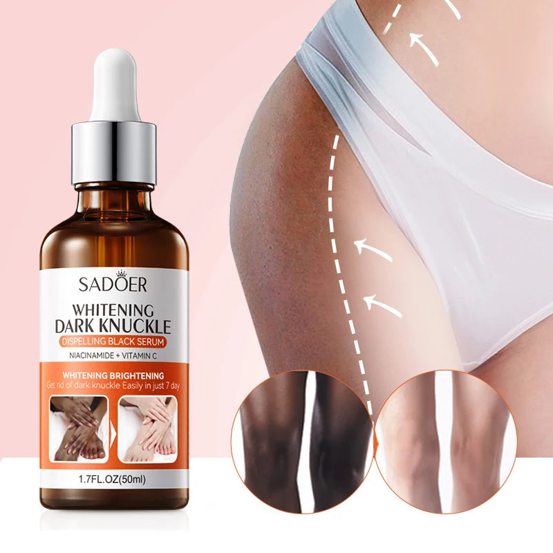 1/3Pcs Dark Knuckles Lightening Serum Hand Knuckle Elbows Knee Lighten Oil Intense Stains Remover Products Beauty Body Care 50ml