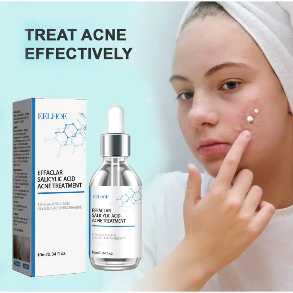 Face Serum Fruit Acid Acne Treatment Oil Control Remove Blackheads Shrink Pores Skin Texture Improve Care