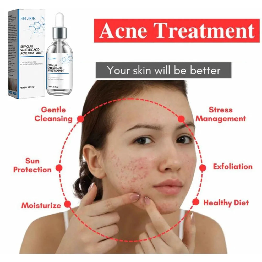 Salicylic Acid  Solution Essence Shrink pores and Acne Spot Removing Shrink Pores Oil-Control Brighten Face Skin Makeup