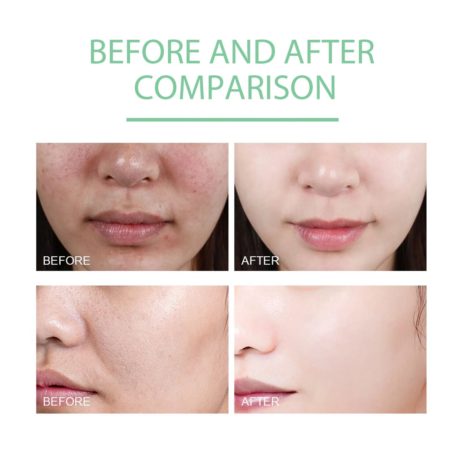 Face Exfoliating Cream Dead Spot Remover Moisturizing Face Scrub Whitening Exfoliating Pores Brightening Exfoliator Peeling Gel