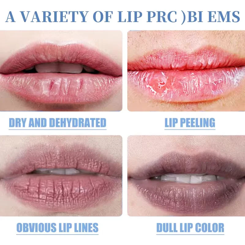 Fast Lightening Pink Mouth Lips Serum Bleaching Permanent Remove Dark Smoke Lips Lip Balm Moisturize Gloss Lipstick Lip Oil