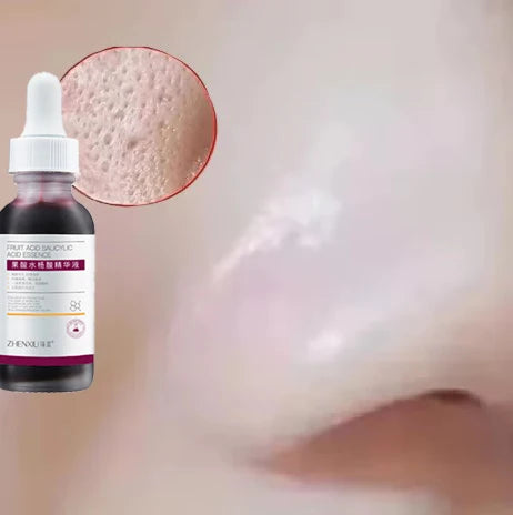 Salicylic Acid Care Essence Deep Hydration Gentle Nourishment Soothes Redness Smooths & Refines Firm Protection 2026