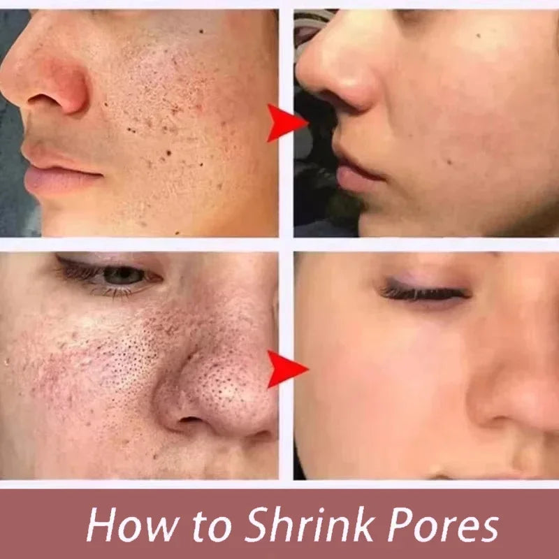 Salicylic Acid Meets Pore Perfection – Shrinks Enlarged Pores, Minimizes Appearance, Firms, Smooths, Tightens – Korean Serum
