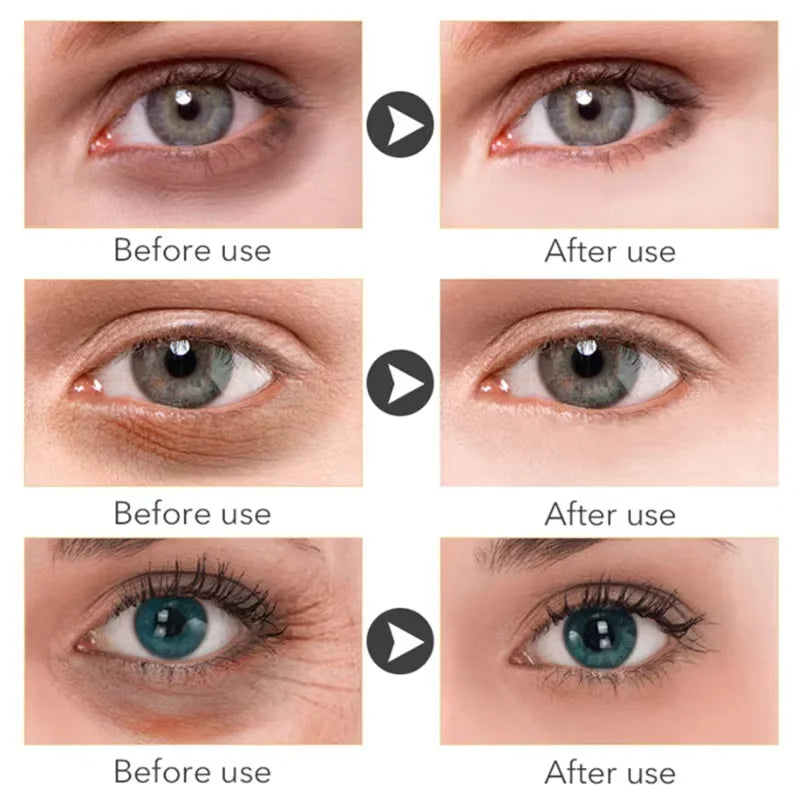 Anti Dark Circle Eye Serum Oil Retinol Anti Wrinkle Firming Lift Skin Remove Eyes Bag Fade Fine Line Whitening Brighten Eye Care